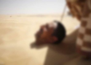 تحذير طبي من “حمَّام الرمل”.. مضاعفاته قد تسبب الوفاة ولا دليل علميًّا على فوائده