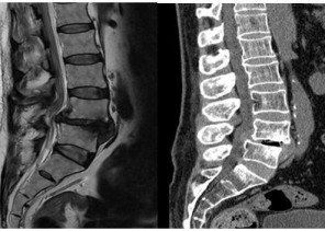 نجاح جراحة نادرة ونوعية لإعادة الحركة لمريض في مستشفى “وادي الدواسر”