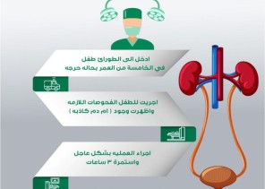 جراحة نادرة لإزالة « أم الدم » من شريان طفل في مستشفى الملك عبدالعزيز بجدة