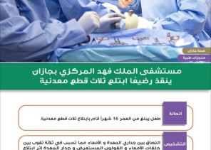 التصقوا بين جداري المعدة والأمعاء .. فريق طبي ينقذ طفل ابتلع 3 قطع معدنية بجازان