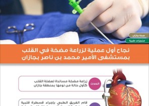 فريق طبي بمستشفى الأمير محمد بن ناصر بجازان يتمكن من زراعة مضخة مساندة لعضلة القلب لمريضة ستينية