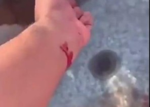 أول رد  من أبن حثلين بشأن الفيديو المتداول  لأشخاص يلوثون  مياة شرب  الأبل بدمائهم !