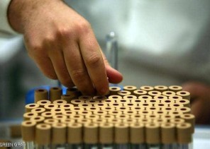 كاشف الأنساب واختيار الأبوة .. الكشف عن فوائد الحمض النووي وهذا مكان تواجده داخل جسم الإنسان!