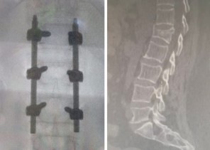 مجمع الملك عبدالله الطبي بجدة يُجري عملية جراحية نوعية لخمسينية بنجاح