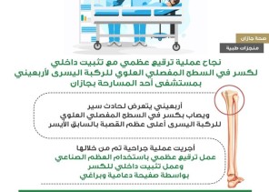 فريق جراحة العظام بمستشفى أحد المسارحة يجري عملية ترقيع عظمي لكسر  في السطح المفصلي للركبة اليسرى أعلى عظم القصبة بالساق اليسرى لمصاب أربعيني