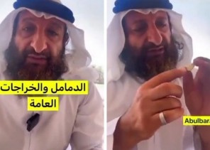 “علاج طبيعي للدمامل والخراج”.. فيديو: معالج شعبي يقدم طريقة فعالة باستخدام الثوم والحجامة