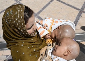 إنفاذًا لتوجيهات القيادة.. وصول التوأم السيامي الباكستاني “سفيان ويوسف” إلى الرياض