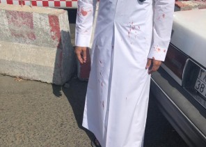 معلم ثانوي بالطائف يتعرض لـ«لكمة دامية» من أحد طلابه.. والسبب غريب (صور)