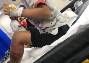والد الطفل الملسوع يفند ادعاءات “صحة جازان” بأنه أخرج ابنه من المستشفى قبل اكتمال علاجه