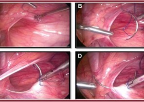 عمليات متقدمة لجراحة الاطفال بيرنامج الخدمات الصحية للهيئة الملكية بالجبيل