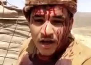 شهيدان نقلاه إلى المستشفى.. الجندي الذي ظهر في فيديو والدماء تغطي ملابسه يوضح الملابسات