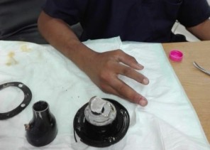 مدني القريات يستخرج يد طفل علقت بفتحة خزان وقود سيارة