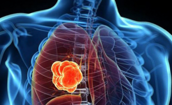 مشروب بـ”ريال” في البقالات يقي من خطر الإصابة بـ”سرطان الرئة”