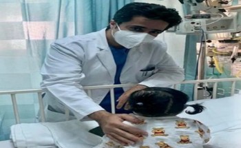 فريق طبي بمركز الأمير سلطان يعالج رضيعة كانت تعاني من تشوهات خلقية