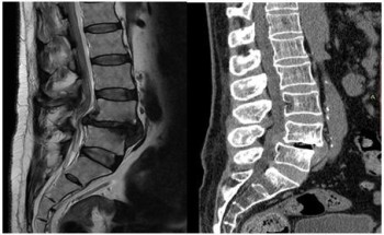 نجاح جراحة نادرة ونوعية لإعادة الحركة لمريض في مستشفى “وادي الدواسر”