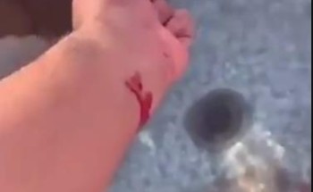 أول رد  من أبن حثلين بشأن الفيديو المتداول  لأشخاص يلوثون  مياة شرب  الأبل بدمائهم !