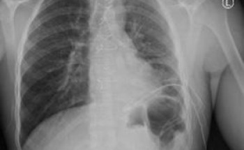 مسار الإصابات في تجمع الرياض الصحي الأول ينقذ حياة شاب تعرض للطعن