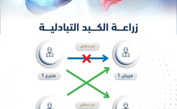 في عملية تعد الأولى من نوعها في الشرق الأوسط نجاح أول زراعة كبد تبادلية في تخصصي الدمام