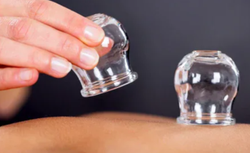 الطب البديل: زيادة الدم المخرج في الحجامة لا تعني فاعلية علاجية أكبر