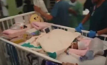 الربيعة يعلن انتهاء عملية فصل التوأم السيامي التنزاني”أنيشيا وملينيز” بنجاح – فيديو