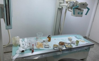 أول تعليق من “صحة جازان” بشأن تحويل جهاز أشعة إلى “سفرة طعام”