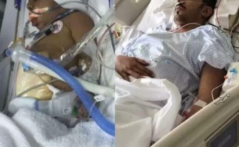 مواطن ينقذ حياة طفل ويتبرع له بجزء من كبده.. وأمير الجوف يكرّمه