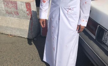 معلم ثانوي بالطائف يتعرض لـ«لكمة دامية» من أحد طلابه.. والسبب غريب (صور)