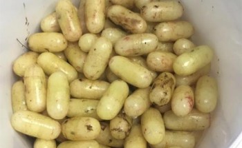 معتمر يحاول تهريب 120 كبسولة حبوب في أحشائه.. وفريق طبي ينقذ حياته بمكة