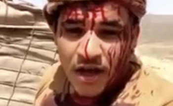 شهيدان نقلاه إلى المستشفى.. الجندي الذي ظهر في فيديو والدماء تغطي ملابسه يوضح الملابسات