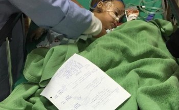 كلب ضال يهاجم طفلاً داخل منزله بتبوك