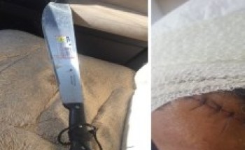 شخص يعتدي على مواطن بساطور أثناء ذهابه لصلاة العشاء بتبوك.. والجهات الأمنية تحقق