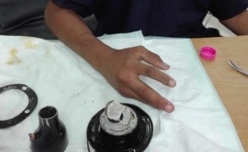 مدني القريات يستخرج يد طفل علقت بفتحة خزان وقود سيارة