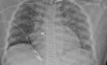 مسار الإصابات بتجمُّع الرياض الصحي الأول يُنقذ حياة  مقيم