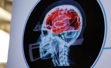 إصابات الرأس توقظ فيروسات الزهايمر.. ارتجاجات خفيفة تنشط “الهربس البسيط 1”