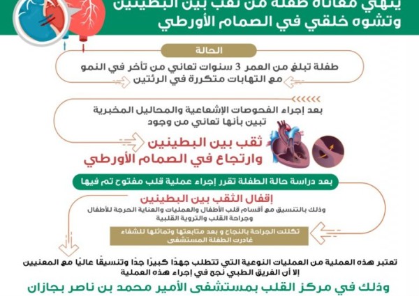 مركز القلب ينهي معاناة طفلة من ثقب بين البطينين وتشوه خلقي في الصمام الأورطي بجازان