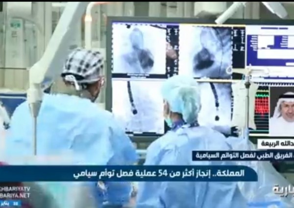 بالفيديو .. الدكتور “عبدالله الربيعة” يكشف تطورات حالة التوأم السيامي العراقي “عمر” و “علي”