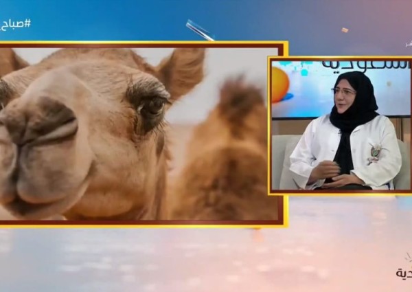 في أحدث دراسة.. حليب الإبل هو الأقرب لحليب الأم