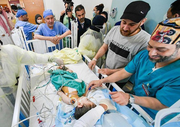نجاح فصل التوأم السيامي السوري ” إحسان وبسام ” بعد عملية جراحية دقيقة استغرقت 7 ساعات ونصف