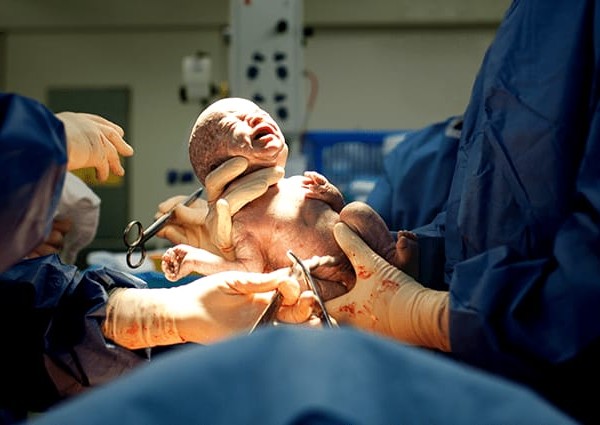 ولادة قيصرية ناجحة للطبيبة ندى إدريس لأبناء إعلامي بالشرقية