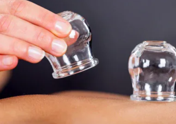 الطب البديل: زيادة الدم المخرج في الحجامة لا تعني فاعلية علاجية أكبر