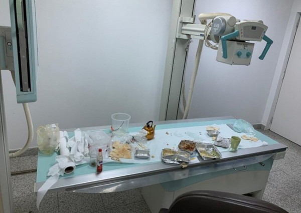 أول تعليق من “صحة جازان” بشأن تحويل جهاز أشعة إلى “سفرة طعام”