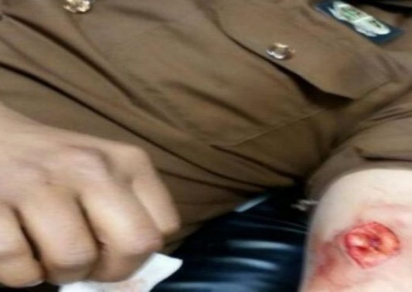 إصابة رجل أمن بـ7 طعنات غادرة أثناء مداهمة وكر لمهربي الحشيش بجازان