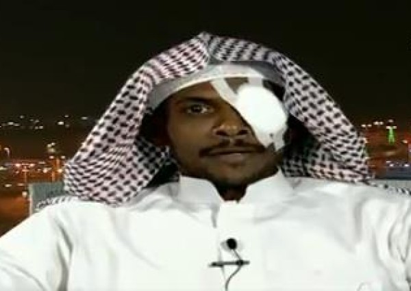 حارس الأمن المعتدى عليه في “مستشفى بيش” يكشف تفاصيل إصابته.. ويروي ما حدث (فيديو)