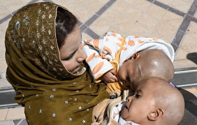 إنفاذًا لتوجيهات القيادة.. وصول التوأم السيامي الباكستاني “سفيان ويوسف” إلى الرياض