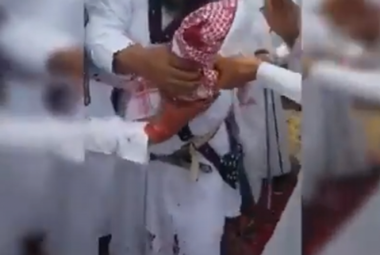 بالفيديو..انفجار “بندقية” في يد أحد المشاركين بعرض شعبي بالباحة