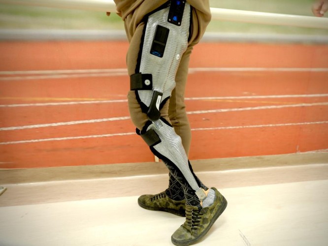 أجهزة تقويمية إلكترونية لمرضى الشلل السفلي بـ “سعود الطبية”