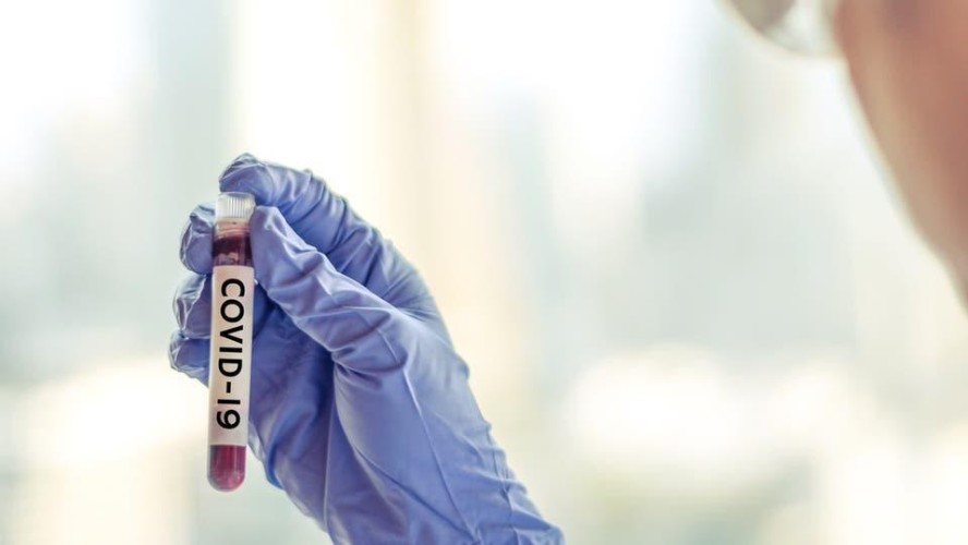 مسؤول أمريكي يعلن إجراء أول اختبار للقاح فيروس “كورونا” اليوم