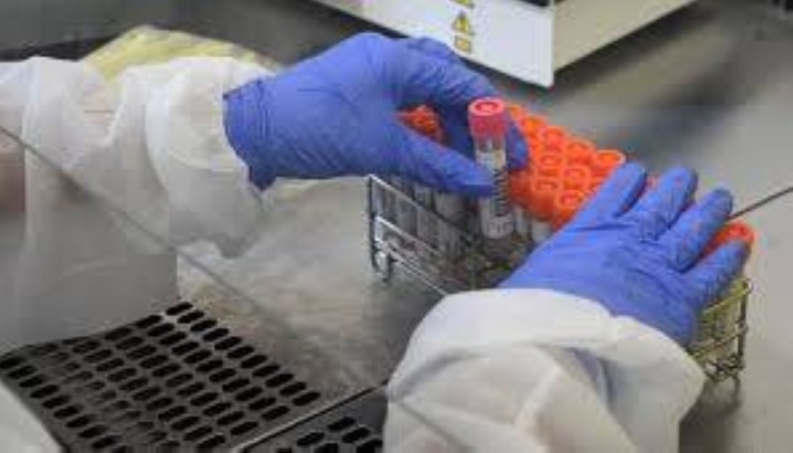 جامعة أكسفورد تنجح في تطوير اختبار سريع قادر على اكتشاف فايروس كورونا في أقل من 5 دقائق