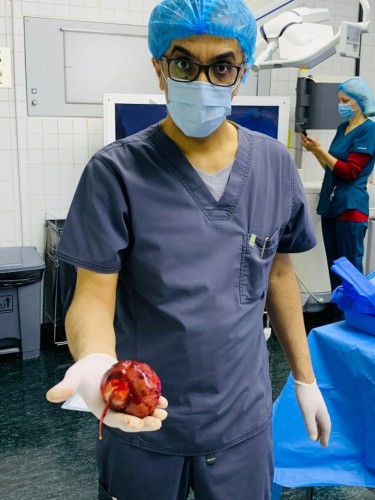 مستشفى الملك سلمان ينجح في استئصال ورم يزن 300 جرام لطفل حديثي الولادة