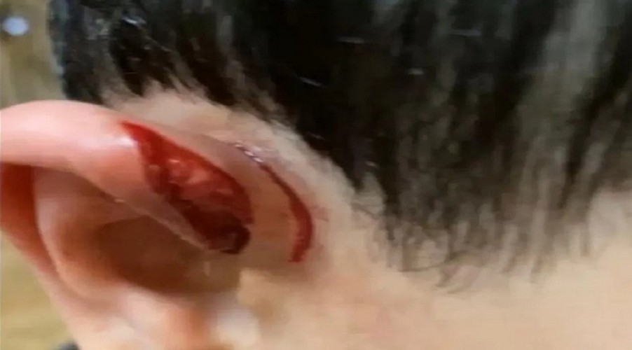 تعرض طفل للإفتراس من ذئب في الأفلاج